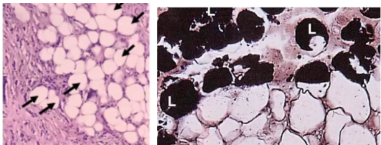 <p><span style="font-family: arial">Type of cytoplasmic inclusion present in adipose cells</span></p>