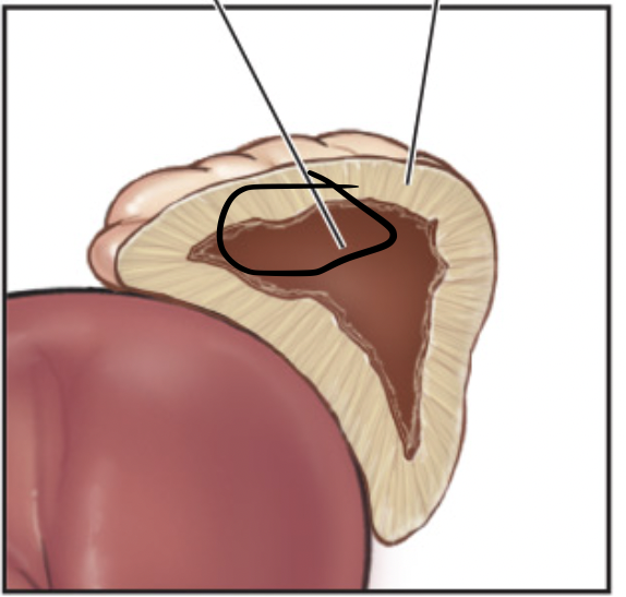 <p>+Adrenal medulla</p>