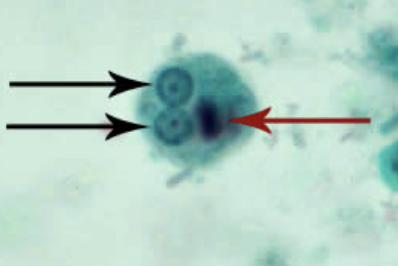 <p>(10-20 um): 1, 2, or 4 nuclei, small central karyosome with even chromatin, cigar-shaped chromatid body</p>