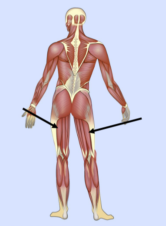 <p>What major muscle is this?</p>