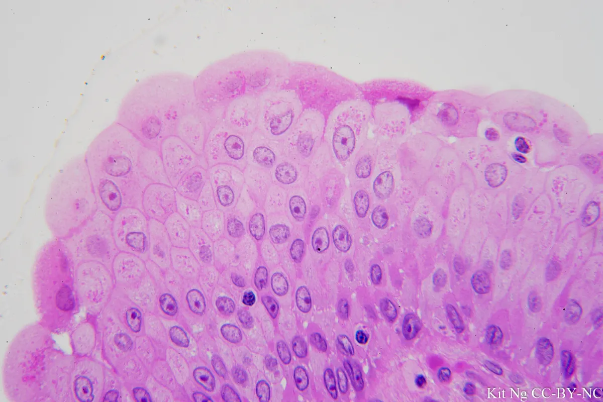 <p>Transitional Epithelium — Description</p>