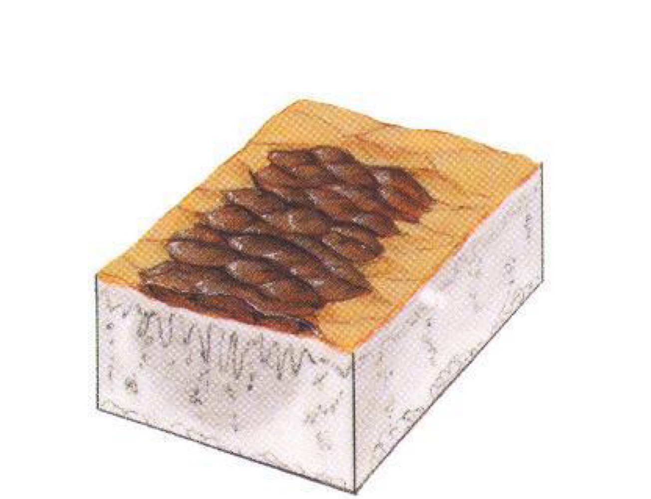 <p>what type of skin lesion is this? </p>