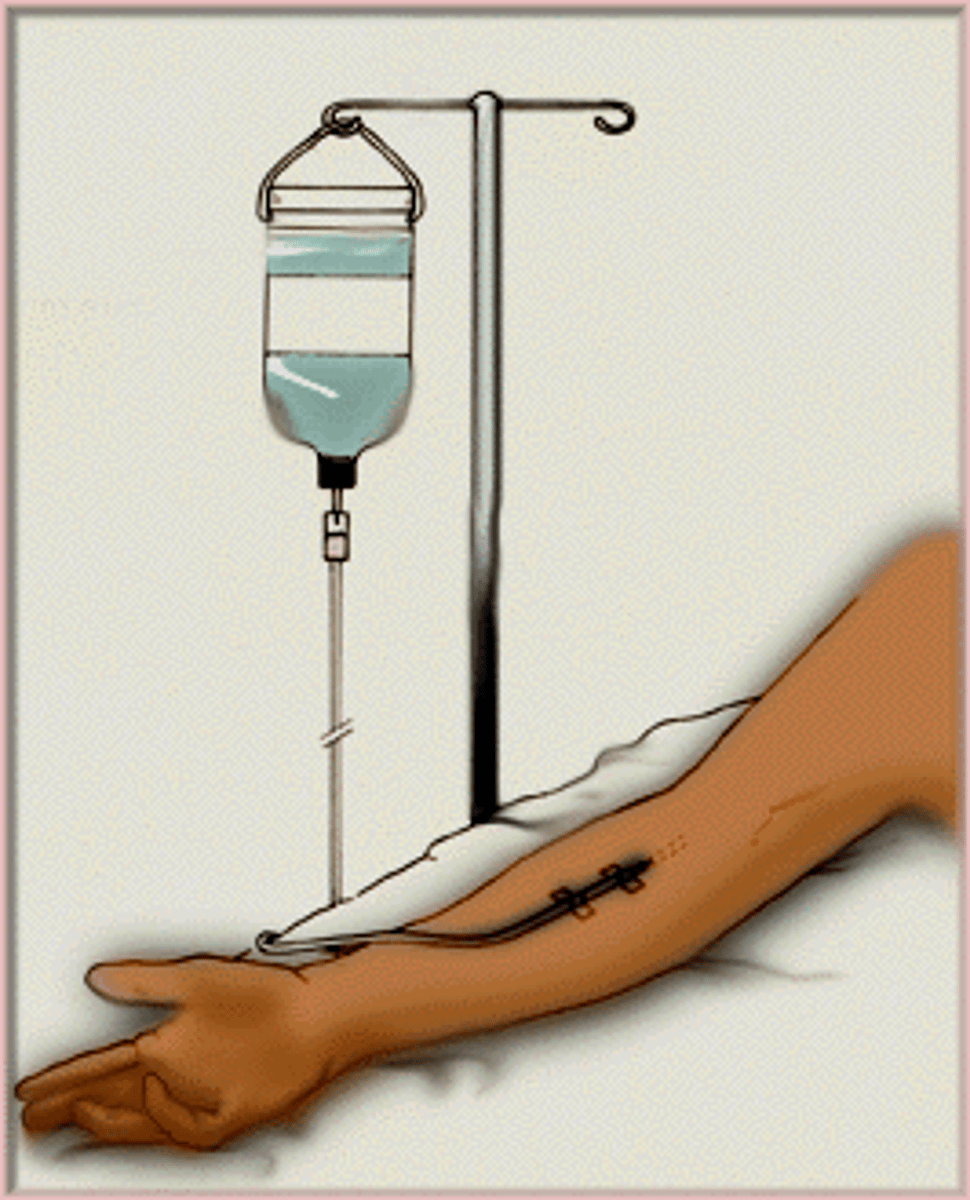 <p>Intravenous</p>