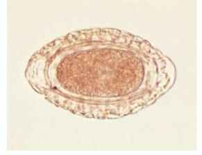 <p>what lifecycle does&nbsp;<span><span>Dioctophyma renale have&nbsp;</span></span></p>