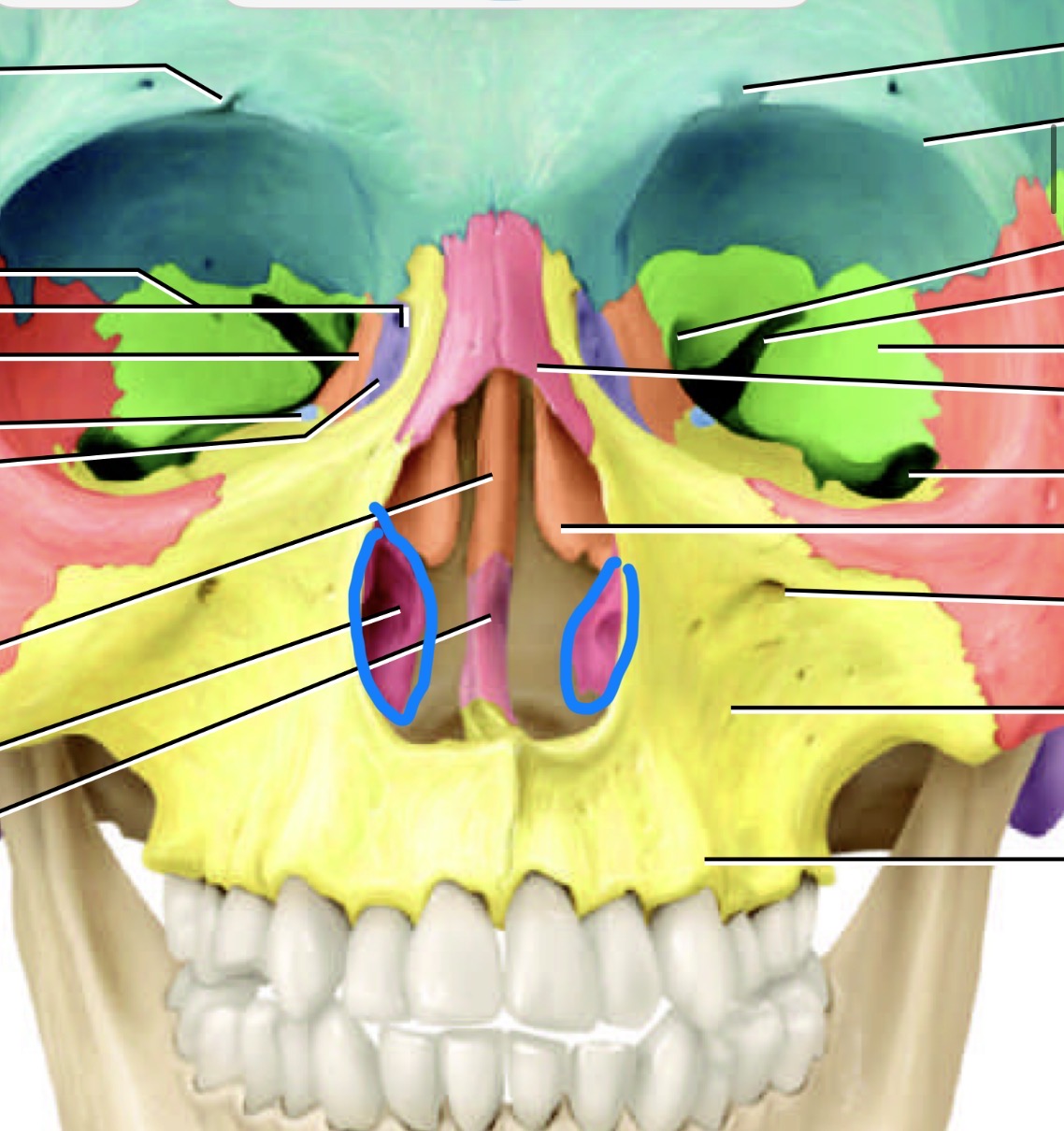 <p>Which bone is this </p>