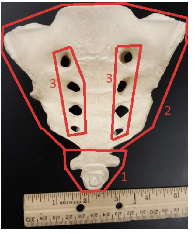 <p>1) name this bone</p>