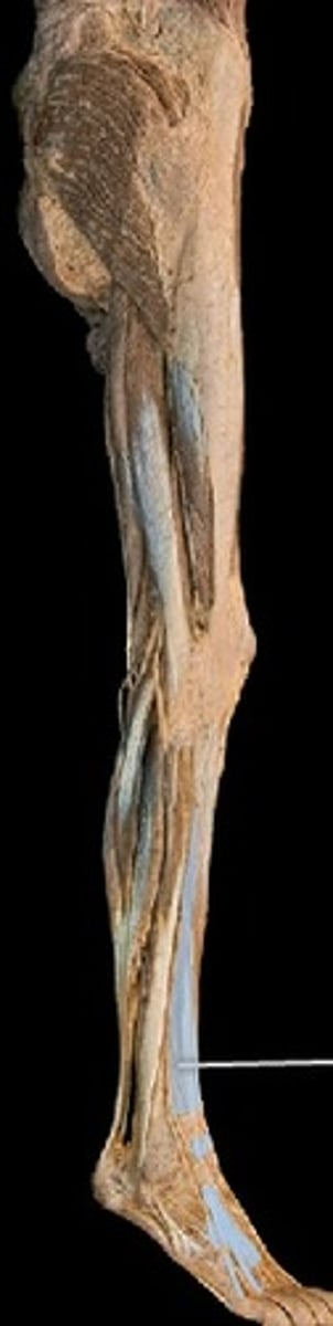 <p>What muscle is this?</p>