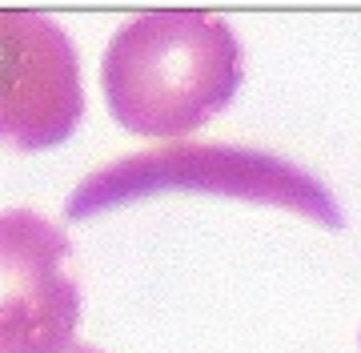 <p>What RBC morphology is this?</p>