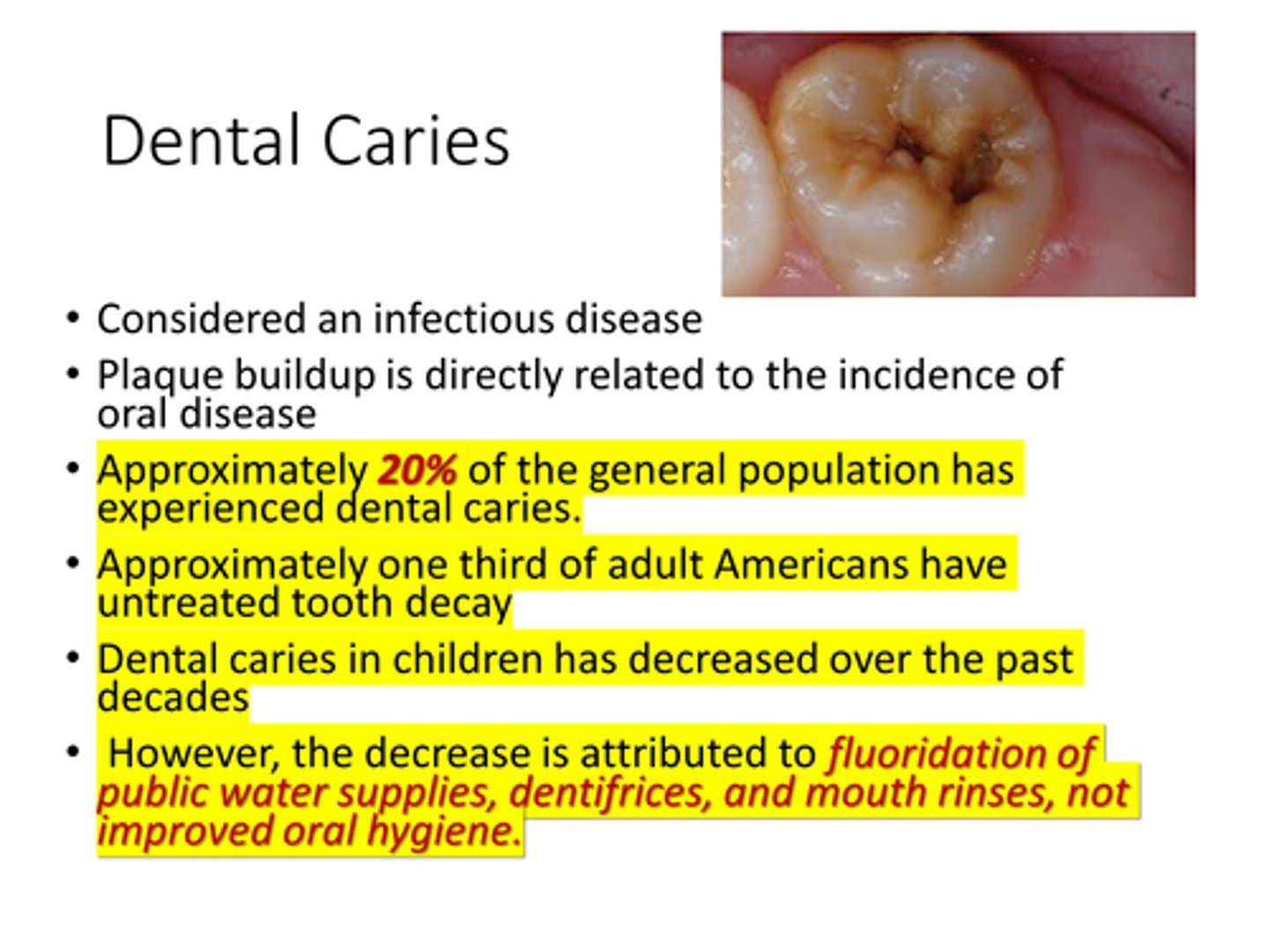<p>False</p><p>Approximately 20% of the general population has experienced dental caries.</p>