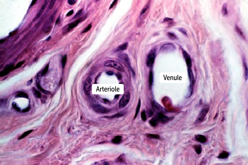 <p>Arterioles </p><ul><li><p>The smallest type of artery</p></li><li><p>lack an external elastic lamina, </p></li><li><p>the internal elastic lamina is often incomplete</p></li><li><p>don’t have to deal with systolic-diastolic pressure changes (the blood pressure is uniform by the time the blood gets to these small vessels), so they need the least amount of elastin.</p></li></ul><p></p>