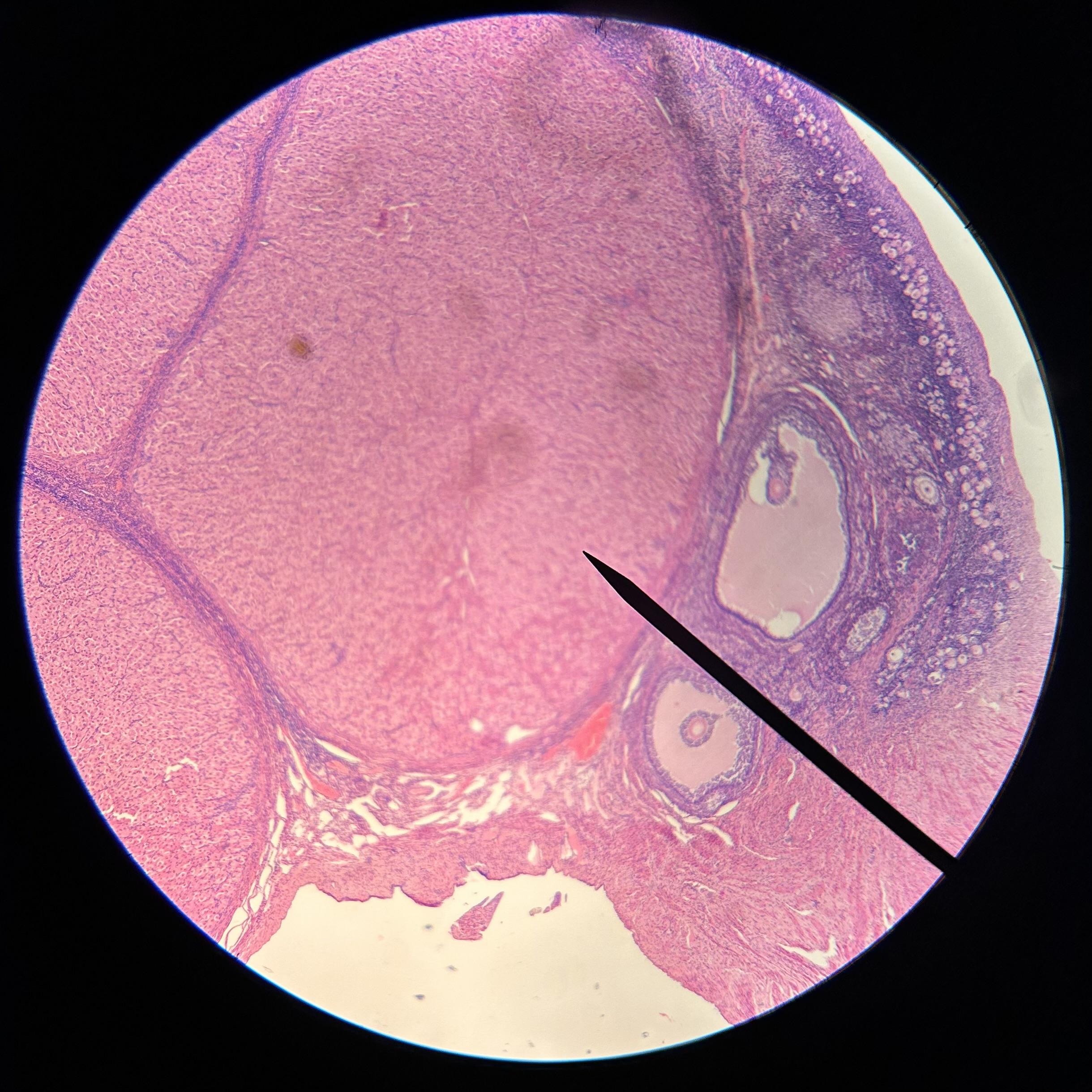 <p>What structure is shown (at pointer)?</p>