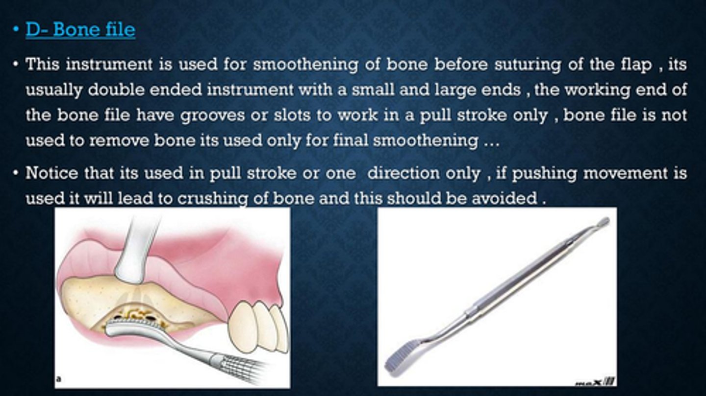 <p>Bone file to SMOOTH bone</p>