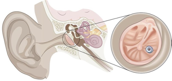 <p>What is the condition or diagnosis called?</p>