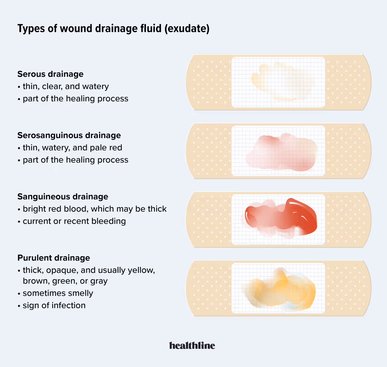 <ol><li><p>Serous drainage</p><ol><li><p>thin, clear, watery</p></li><li><p>part of healing process</p></li></ol></li><li><p>Serosanguinous drainage</p><ol><li><p>thin, watery, and pale red </p></li><li><p>part of the healing process</p></li></ol></li><li><p>Sanguineous drainage </p><ol><li><p>bright red blood, which may be thick </p></li><li><p>current or recent bleeding </p></li></ol></li><li><p>Purulent drainage </p><ol><li><p>think, opaque and usually yellow, brown, green, or gray </p></li><li><p>sometimes smelly </p></li><li><p>sign of infection</p></li></ol></li></ol><p></p>