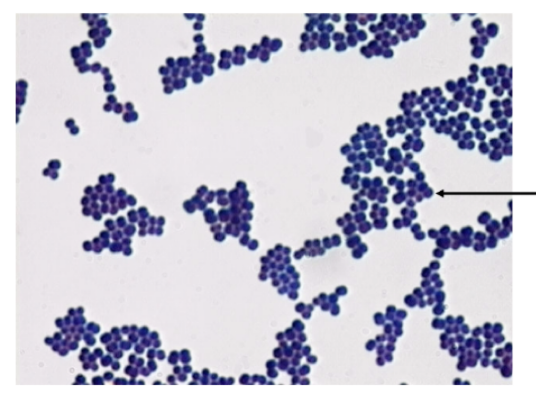 <p>1) identify the grams stain reaction</p><p>2) identify this bacterial shape</p><p>3) arrangement </p>