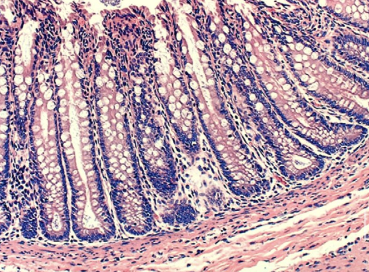 <p>Specify the type of epithelium and its secretory cells.</p>