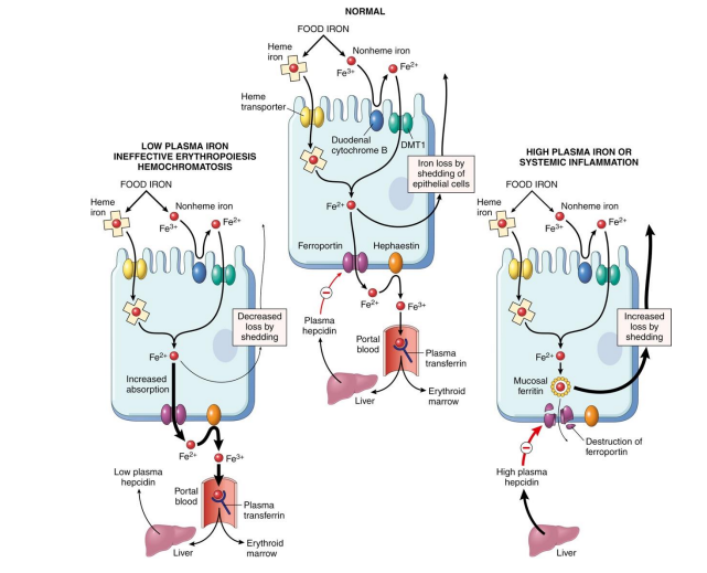 <p>Disruptions to Regulation of Iron Absorption in Haemochromatosis, Inflammation</p>