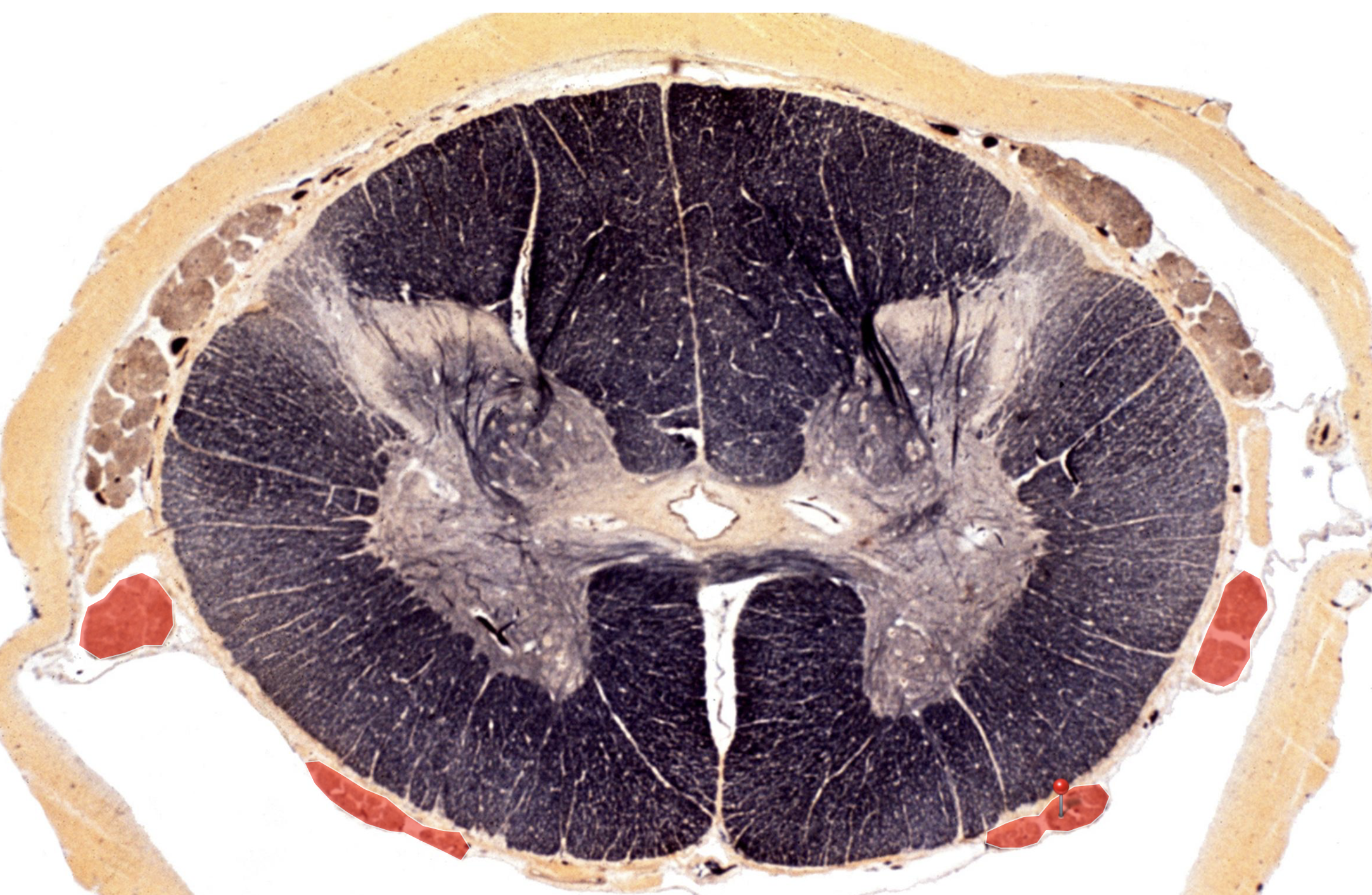<p>Ventral Root</p>