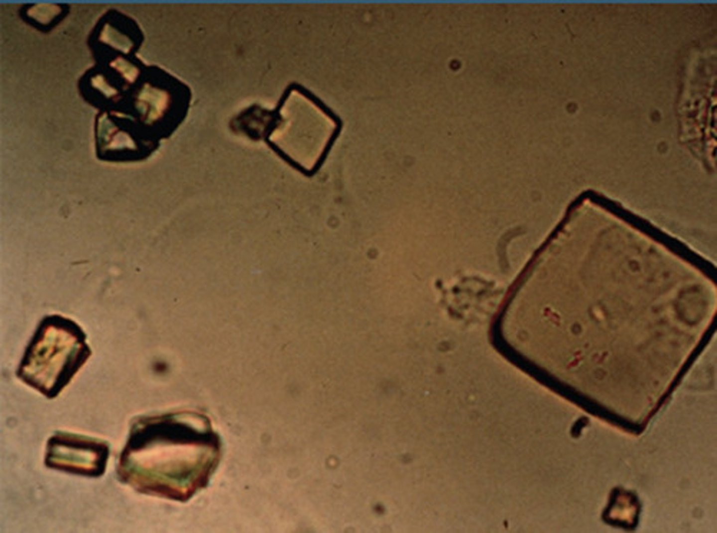 <p>Rhomboids, Hexagons, or Squares</p><p>Acidic Urine (Gout)</p>