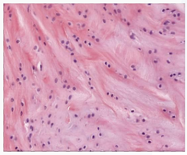 <p>tough, very strong tissue found predominantly in the intervertebral discs and at the insertions of ligaments and tendons; it is similar to other fibrous tissues but contains cartilage ground substance and chondrocytes</p>