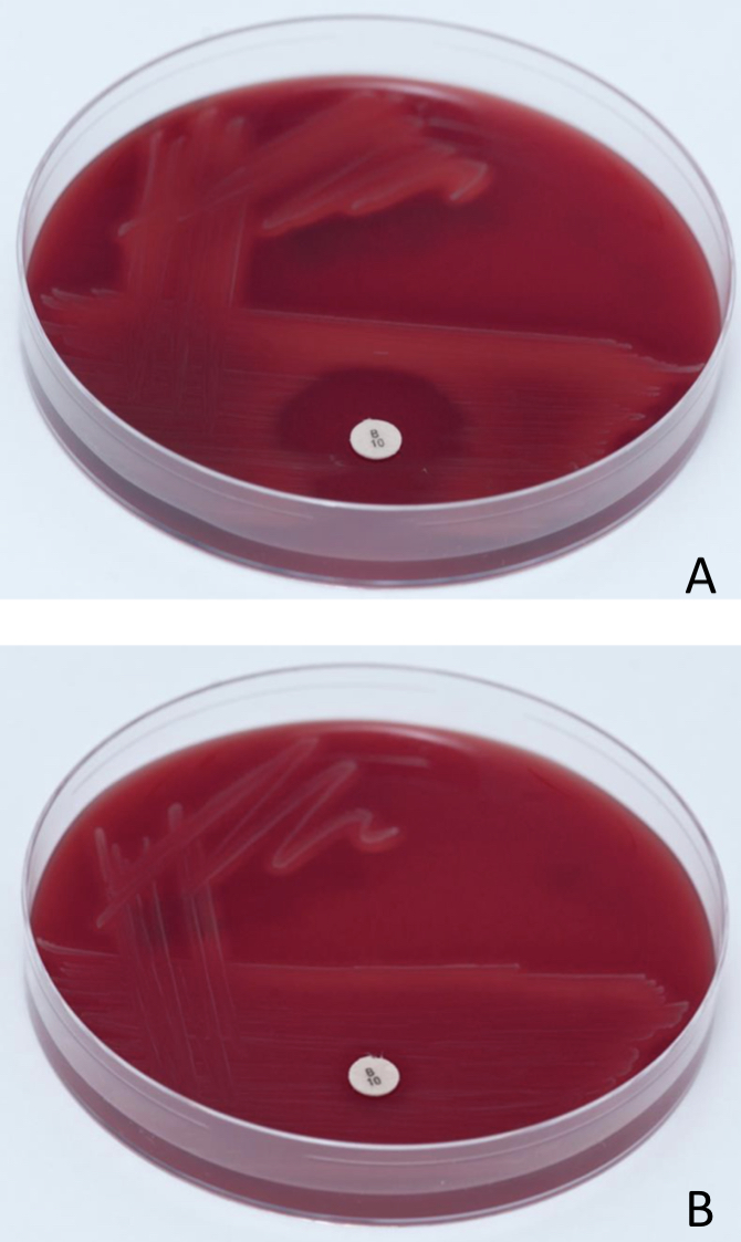 <p>Bacitracin sensitivity test</p>