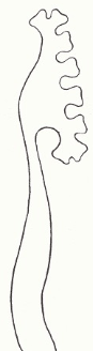 <p>Welke graad reflux wordt beschreven: Matige caliciële dilatatie met stompe calices mara geen tortueuze ureter.</p>