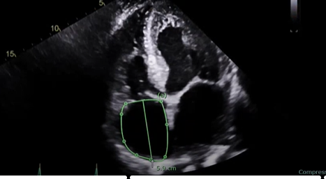 <p>what measurement is this for</p>