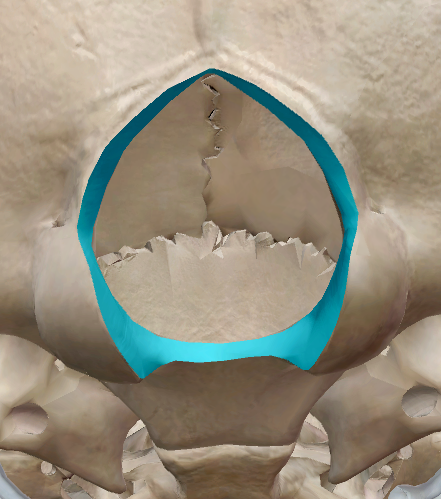 term image