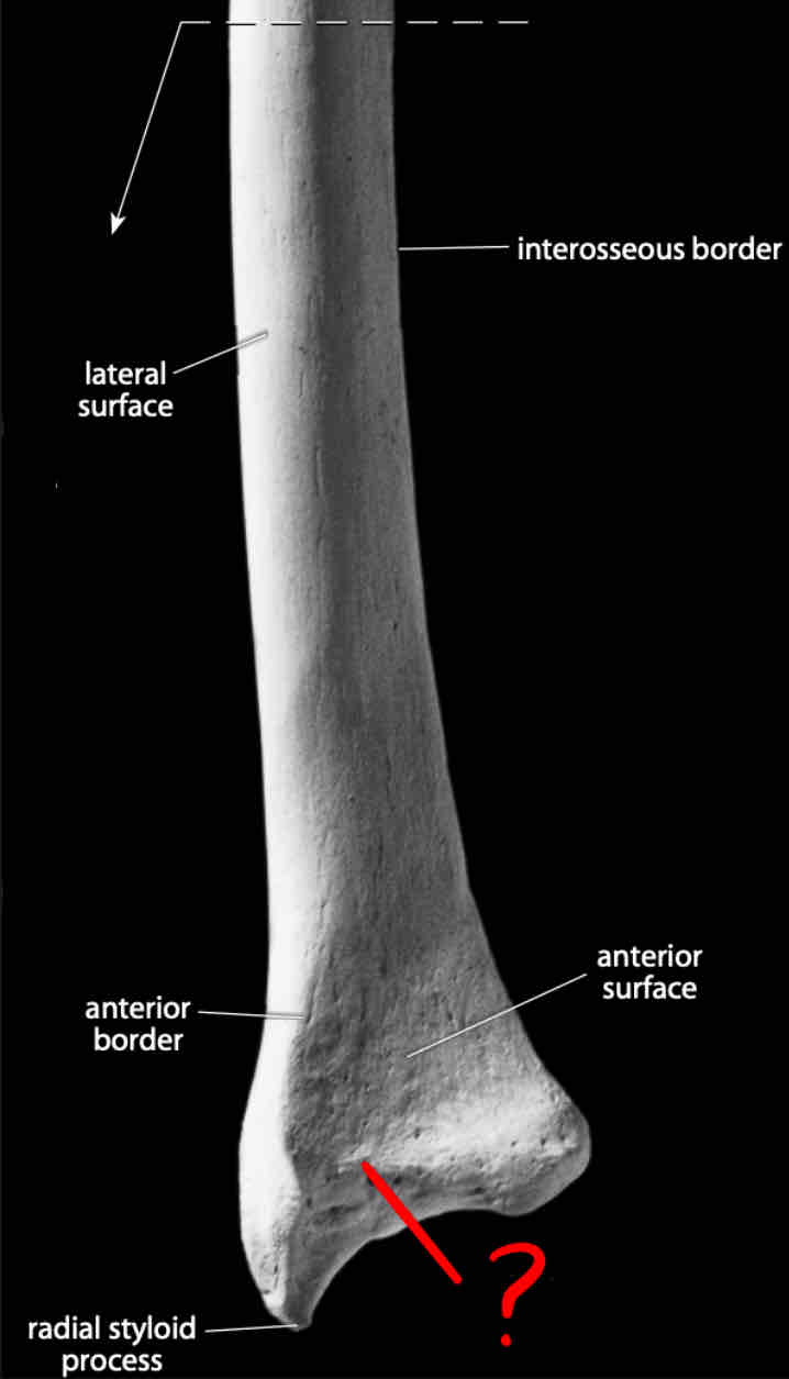term image