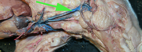 <p><span>The vein marked by the green arrow is the</span><br><span><strong>external jugular </strong>vein.</span></p>