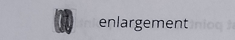 <p>Enlargement </p>