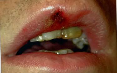 <ul><li><p>Identify the disease</p></li><li><p>Clinical feature</p></li></ul><p></p>