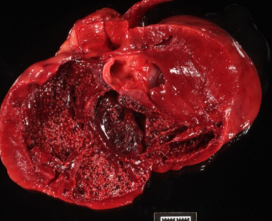 <p>Describe this post mortem finding</p>