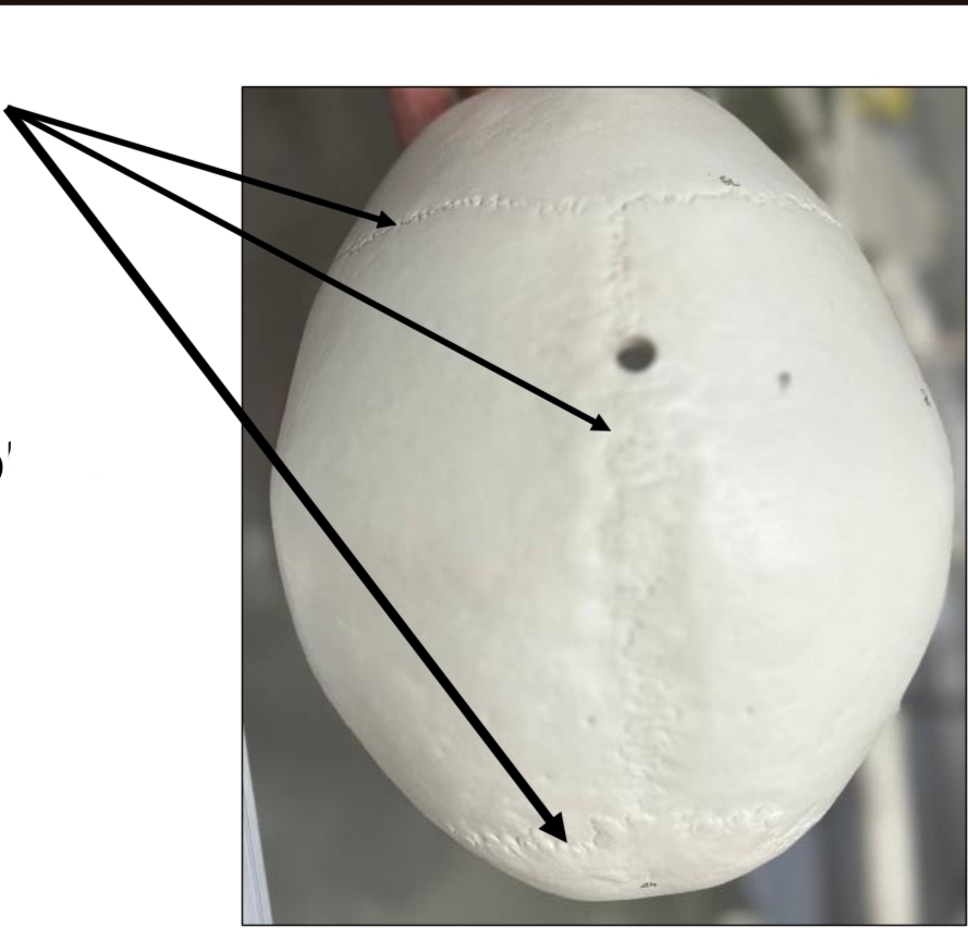 <p>identify joint type</p>