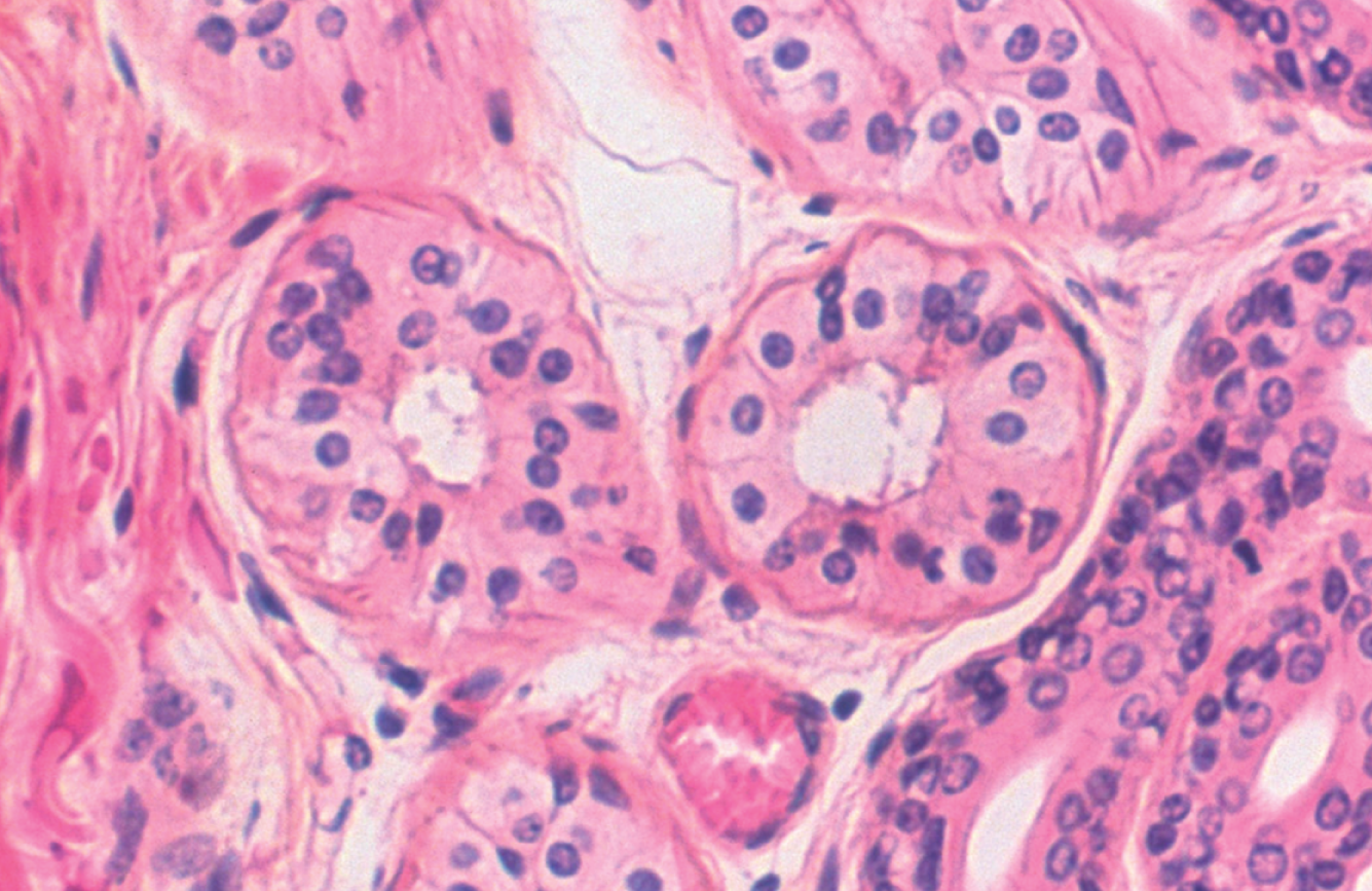 <p>Can be found in certain glands or ducts </p>