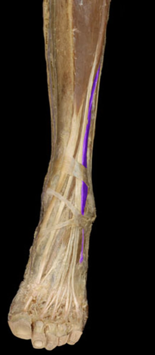 <p>While not always present, it lies at the level of the extensor digitorum longus, just lateral to it.</p>