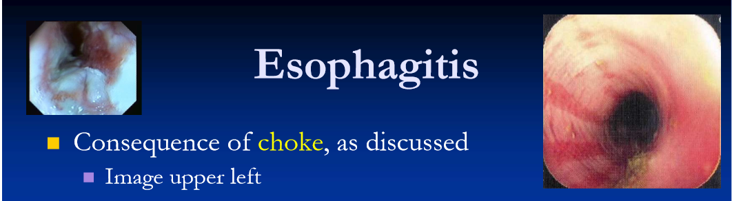 <ul><li><p>Consequence of <strong>choke, </strong></p></li><li><p><strong>reflux esophagitis </strong></p><ul><li><p>chemical injury from reflux or gastric acid/bile salts, affecting lower esophagus </p></li><li><p>complication of <strong>gastro-duodenal ulceration </strong>in foals (mostly) causing pyloric stenosis and gastric outflow obstruction </p></li><li><p>other causes of RE are <strong>SI obstruction causing entero-gastric reflux, </strong>gastritis and or gastric dilatation of any origin esophageal and gastric motility disorders incompetence of lower esophageal sphincter </p></li></ul></li><li><p>chemical injury from drugs (ex PBZ), toxicants, toxins (ex cantharidin) </p></li></ul><p></p>