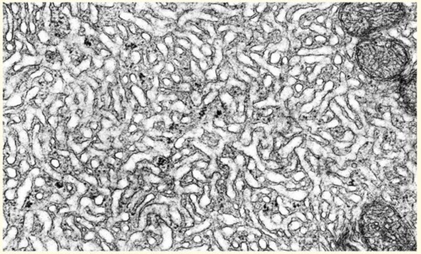 <p>• Not associated with ribosomes (smooth appearance)</p><p>• Site of lipid, phospholipid and steroid synthesis </p>