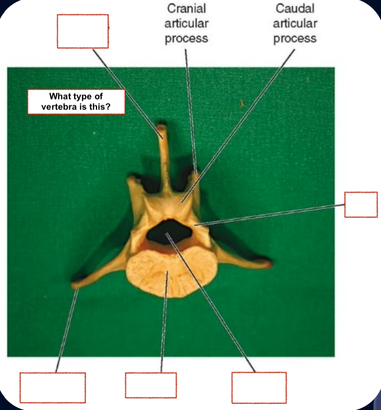 <p>Spinous process</p><p>Transverse process</p><p>Vertebral foramen</p><p>Body</p><p>Arch</p>