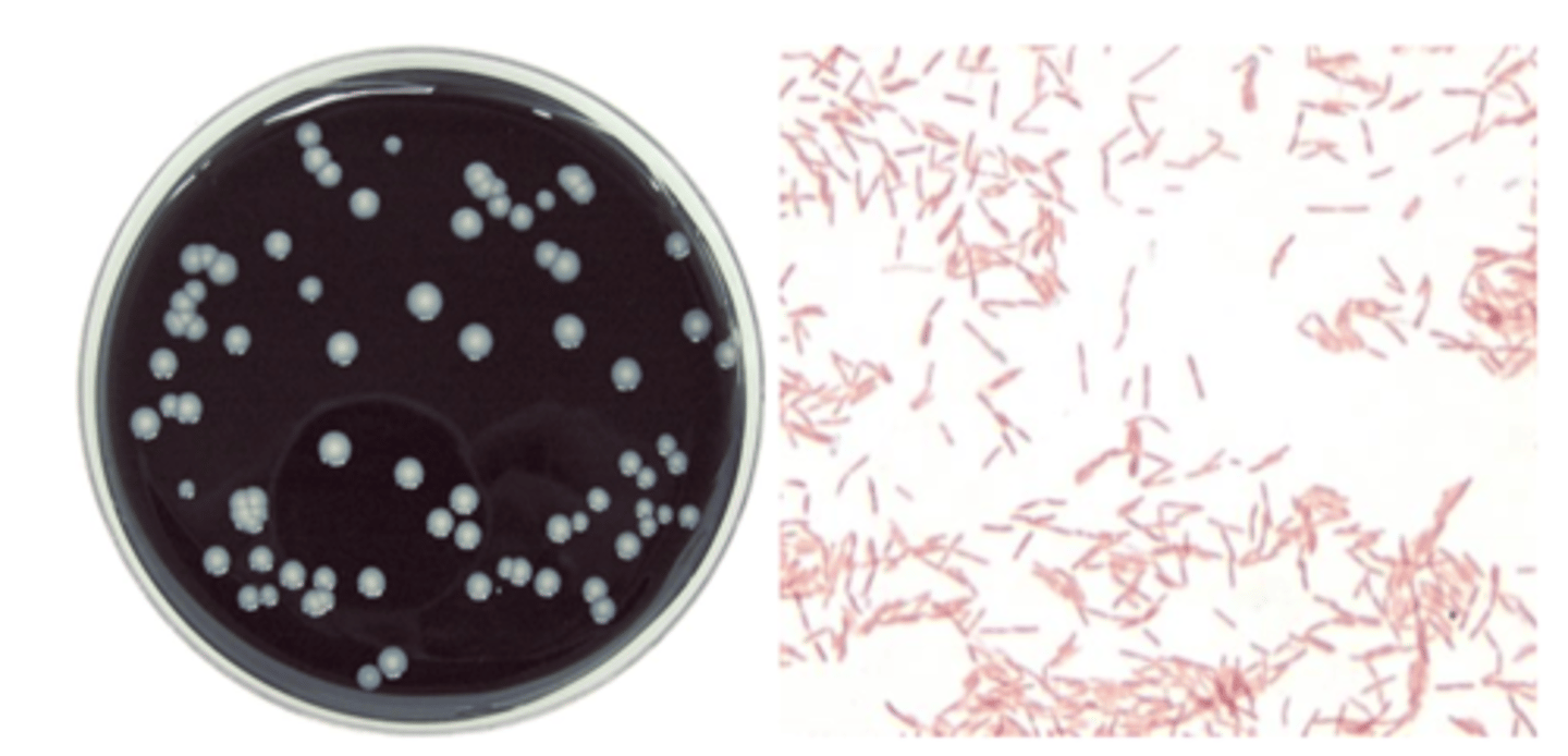 <p>Specimen treatment to reduce contaminants</p><p>Growth on Buffered Charcoal Yeast Extract (BCYE)</p><p>No growth on blood</p><p>Carbolfuchsin counterstain</p><p>We’re bad at growing this</p>