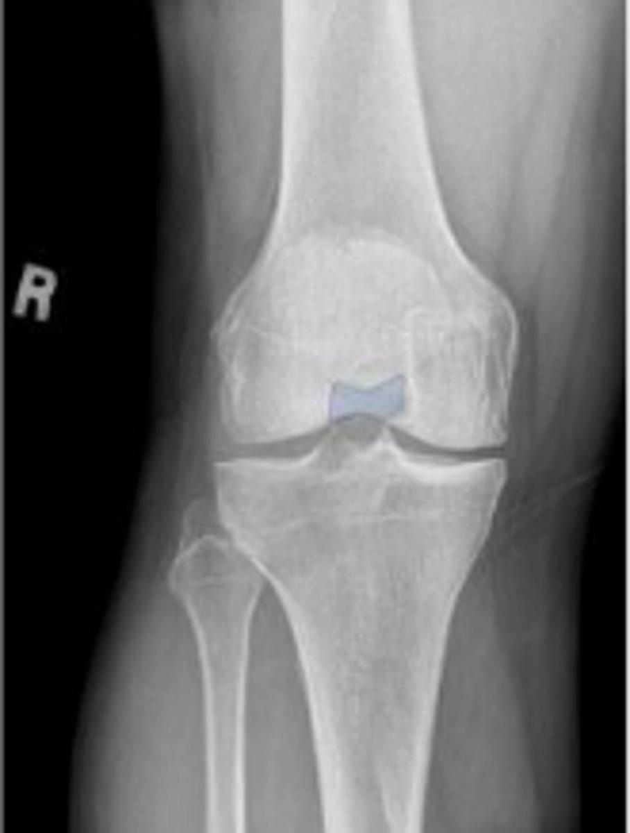 <p>What is outlined?</p>