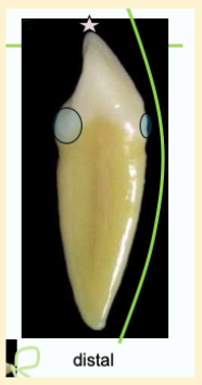 <p><mark data-color="#ffc1ec" style="background-color: #ffc1ec; color: inherit">mandibular canines #22 and #27; proximal view</mark></p>