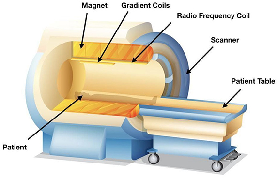 <ul><li><p>Made in 1991</p></li><li><p>Allowed us to visualize the brain activity when a person is doing smth-eg. making a decision, etc.-researchers use this to help correlate behaviour with activity patterns in specific parts of the brain</p></li><li><p class="has-focus">Good</p></li><li><p class="has-focus">Moderate-limited by speed of blood vessel dilation</p></li><li><p class="has-focus">Visualize real-time brain activity during complex behavioral tasks-can see which parts of brain are active and working thru blood flow change</p></li><li><p class="has-focus">Person can't have any metal (cause there’s a risk of injury or death due to the strong magnetic field if metal), test conditions make it difficult to assess children and those with anxiety/panic disorders (loud, small space, etc.) without endangering the patient, and data is hard to analyze + frequently has false positives (cause the change in BOLD signal is super small). Also, it assumes increased blood flow is directly correlated with the amnt. of neural activity which isn’t always the case</p></li><li><p class="has-focus">Study areas of the brain that are most responsive to specific tasks/conditions/emotions</p></li></ul><p>What is it?</p><ul><li><p>Has 2 components-</p><ol><li><p>A machine</p><ul><li><p>As the person goes thru it, a powerful magnet revolves around their head (stronger the magnet better the spatial res. btw)</p></li><li><p>Circular tunnel</p></li></ul></li><li><p>A device that emits radio waves</p><ul><li><p>Revolves around head</p></li></ul></li></ol></li><li><p>Both components interact with protons-when protons enter a strong magnetic field, they align with or directly against the direction of the field. When it by radio waves, the protons lose their alignment going into a hi energy state. The protons will then fall back into a low energy state and return to alignment with the magnetic field.</p></li><li><p>The MRI detects this process</p></li><li><p>Since protons in oxygenated hemoglobin are sensitive to a magnetic field (diamagnetic) while in deoxygenated hemoglobin is not (paramagnetic), we are able to measure changes in oxygenation levels</p></li><li><p>MRI’s also rely on the fact that more metabolically active areas in the brain + body need more oxygen (like a PET scan with glucose)-they detect a change in blood flow (cause blood vessels dilate when need more oxygen)-This is called blood oxygenation lvl-dependent signal (BOLD signal)</p></li></ul><p></p>