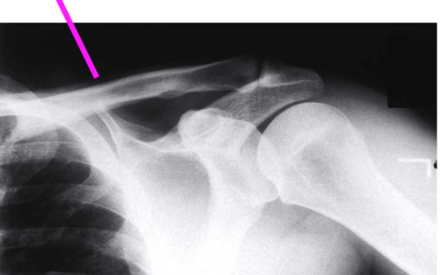 <p>what does the pink line point to?</p>