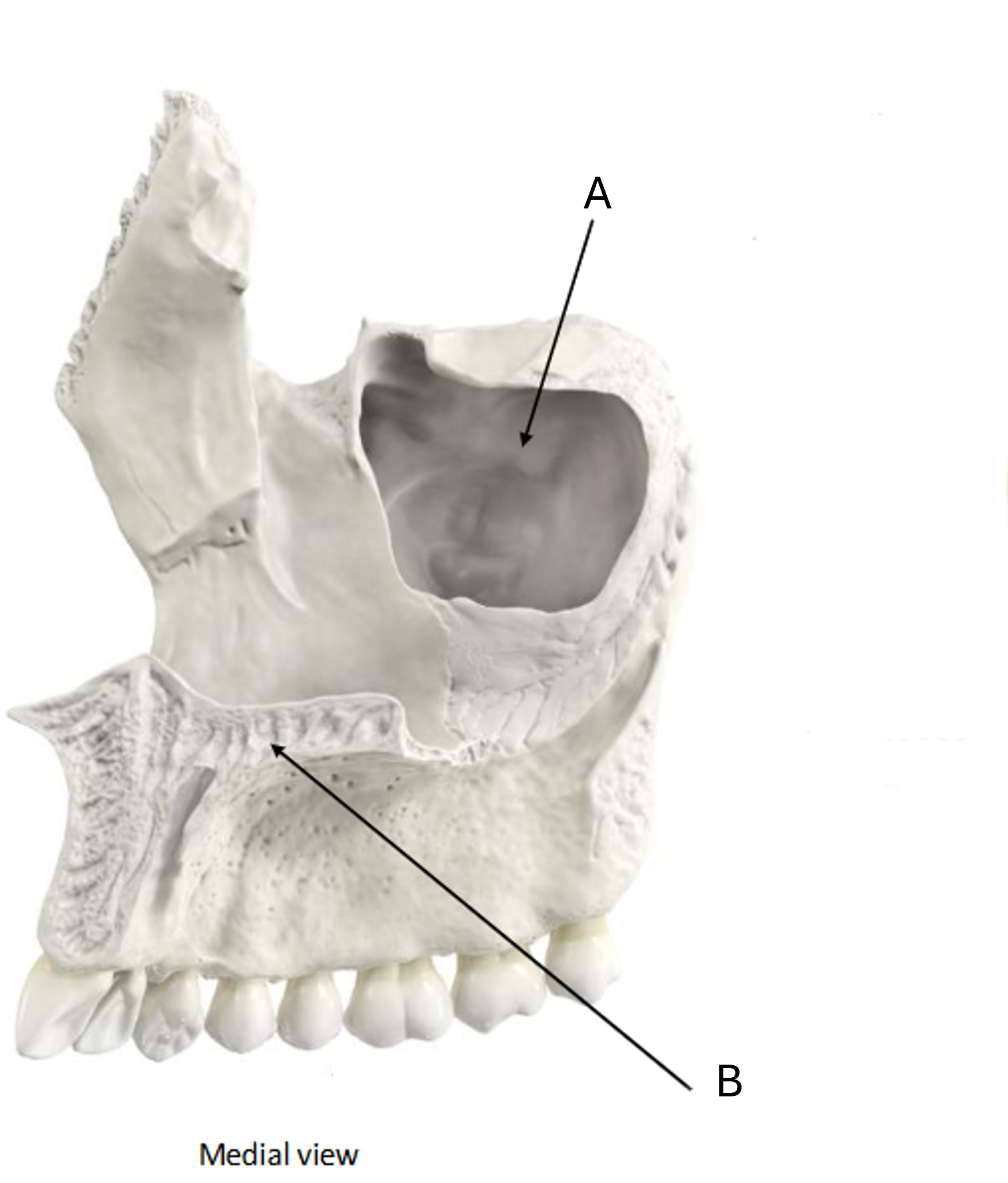 term image