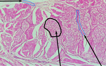 <p>Identify this muscle,blue lines, & type of layer?</p>