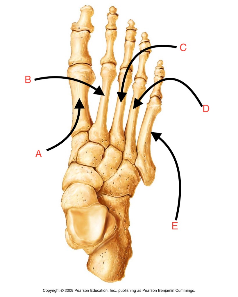 <p>What is the name of this bone group?</p>
