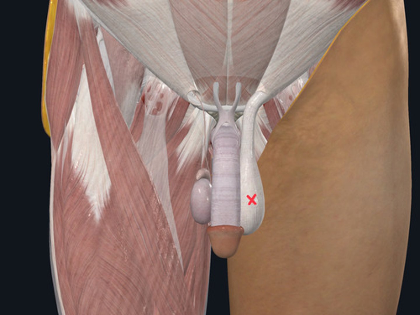 <p>ID Structure Marked with the Red X</p>