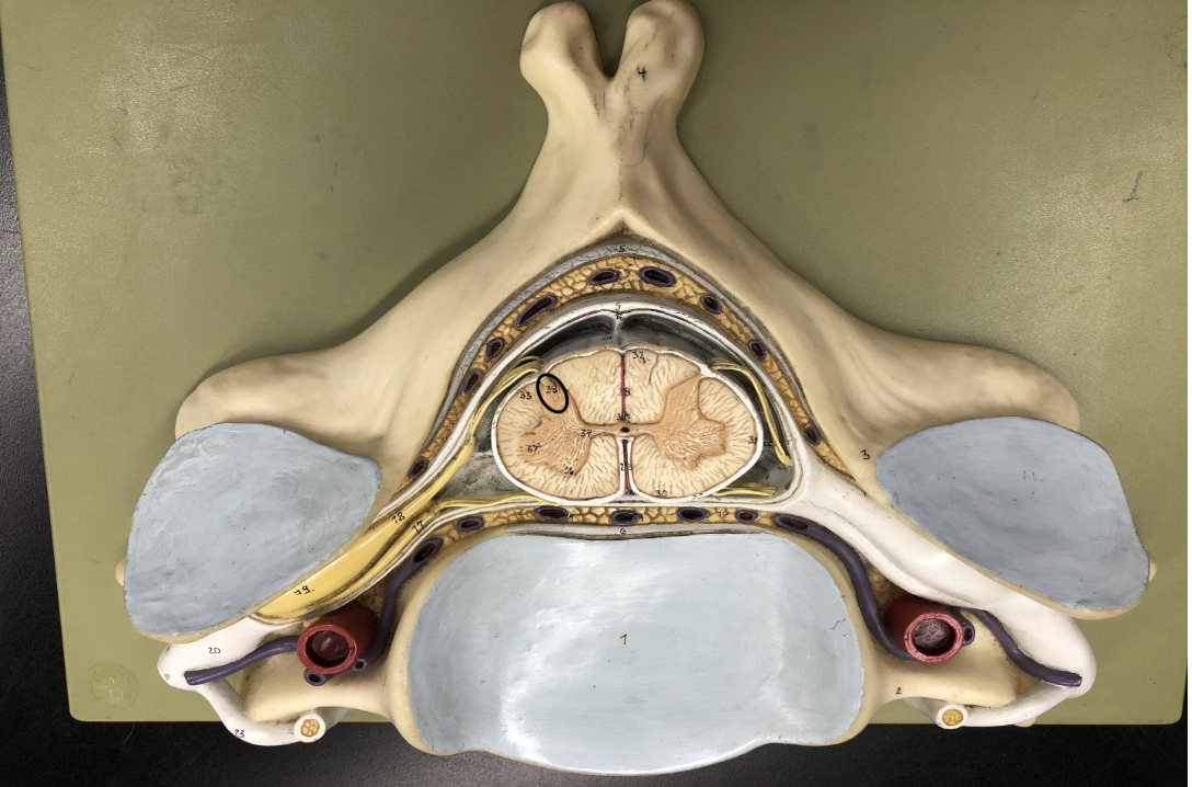 <p>what is this part of the vertebrae (of the spinal cord?)</p>