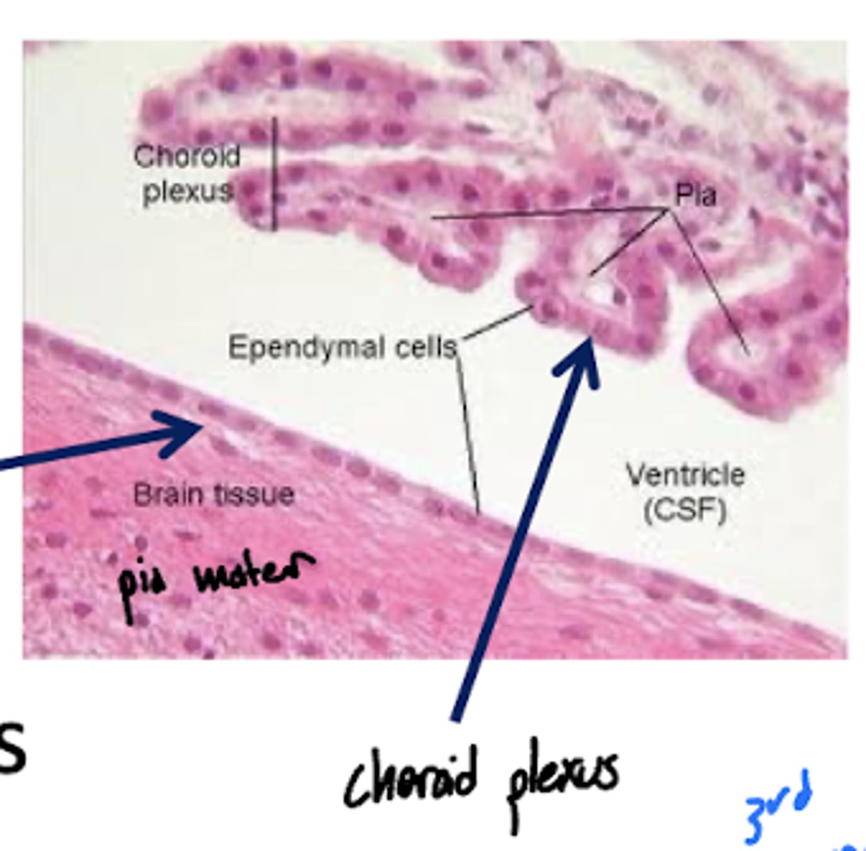 <p>spongy mass of blood capillaries that produces CSF</p>